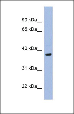 Anti-PIM1, (N-terminal) antibody produced in rabbit