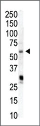 Anti-PIP5K1A (N-term) antibody produced in rabbit