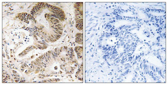 Anti-PIK3R5 antibody produced in rabbit