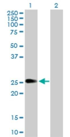 Anti-PIP5K1C antibody produced in rabbit