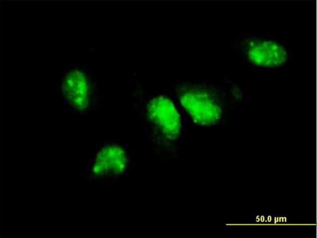 ANTI-PIM1 antibody produced in mouse