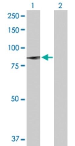 Anti-PLA2G6 antibody produced in rabbit