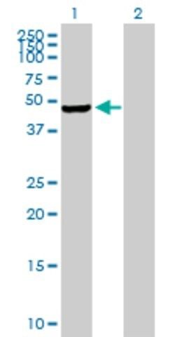 Anti-PIP4K2C antibody produced in mouse