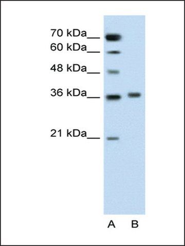 Anti-PIPOX antibody produced in rabbit