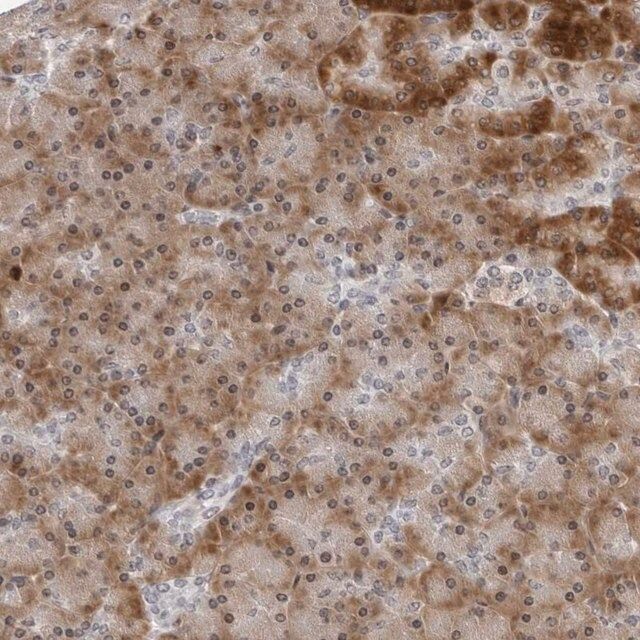 Anti-PIP4K2C antibody produced in rabbit