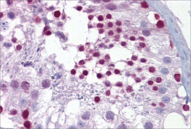 Anti-PITX3 antibody produced in rabbit