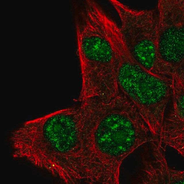 Anti-PLA1A antibody produced in rabbit