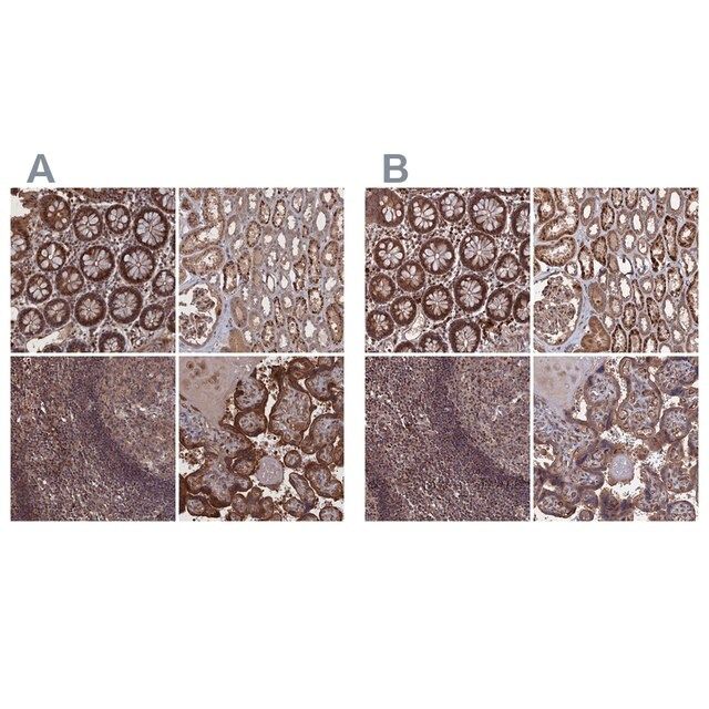 Anti-PLA2G15 antibody produced in rabbit