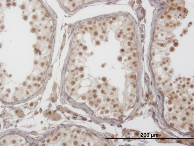 ANTI-PIM1 antibody produced in mouse