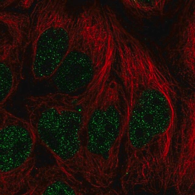 Anti-PITX2 antibody produced in rabbit