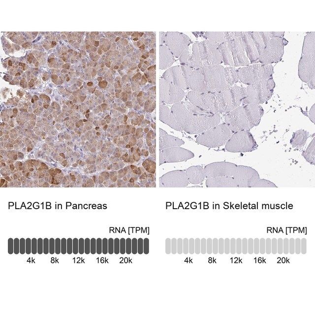 Anti-PLA2G1B antibody produced in rabbit