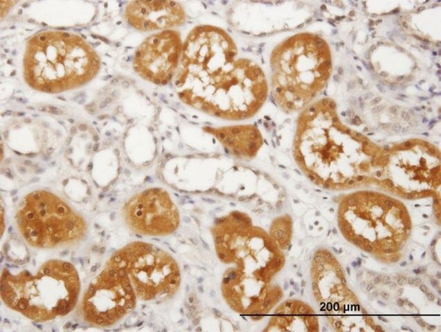 Anti-PKLR antibody produced in mouse