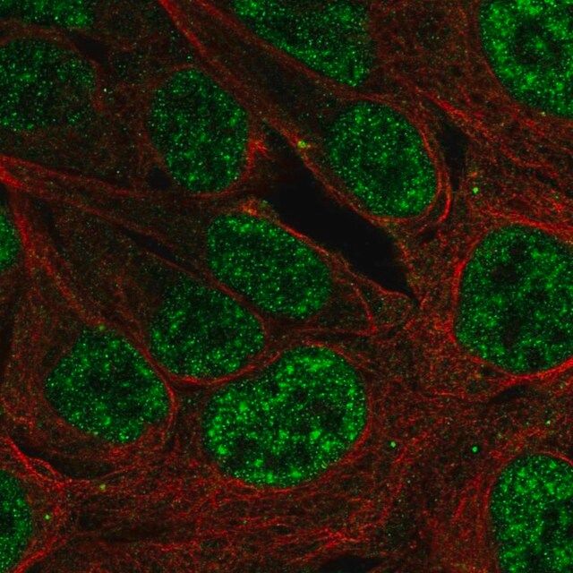 Anti-PLAG1 antibody produced in rabbit