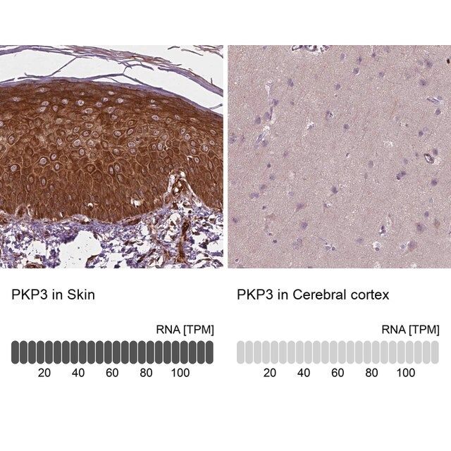 Anti-PKP3 antibody produced in rabbit