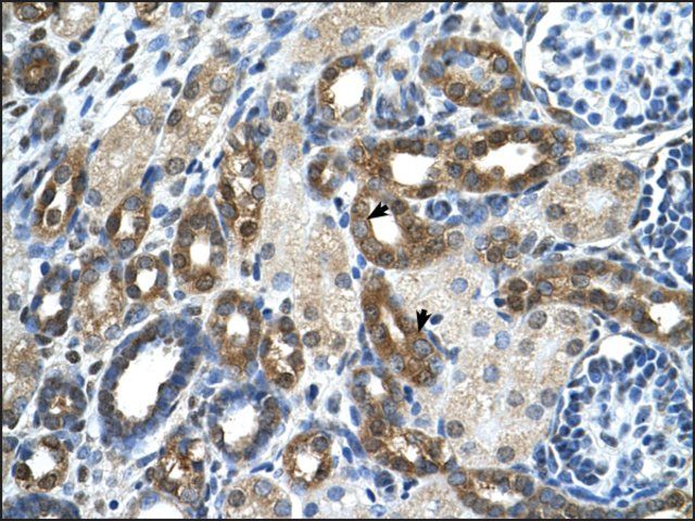 Anti-PKLR antibody produced in rabbit