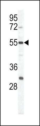 ANTI-PKM1 (C-TERM L398) antibody produced in rabbit