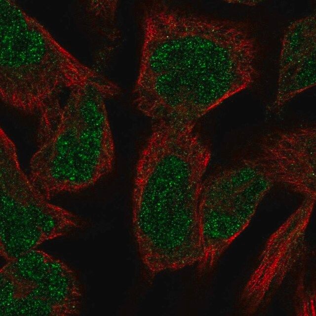 Anti-PKNOX2 antibody produced in rabbit