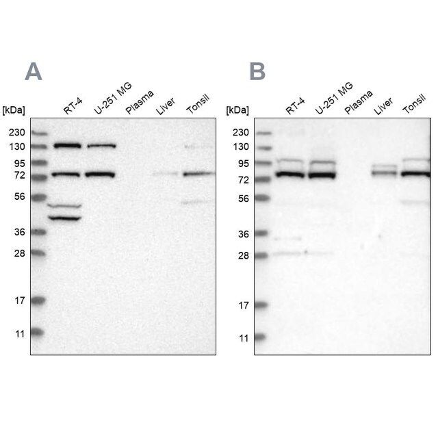 Anti-PLAA antibody produced in rabbit