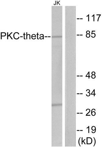 Anti-PKC THET antibody produced in rabbit