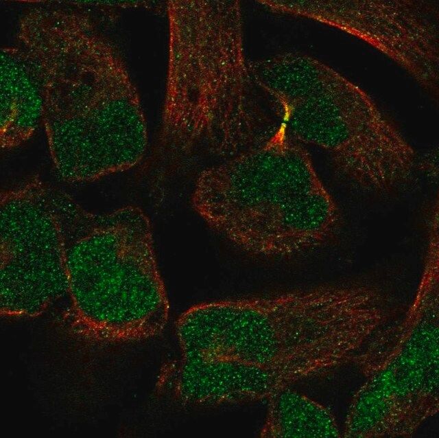 Anti-PKNOX2 antibody produced in rabbit