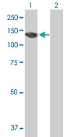 Anti-PKN3 antibody produced in mouse