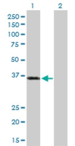 Anti-PKD1L2 antibody produced in rabbit