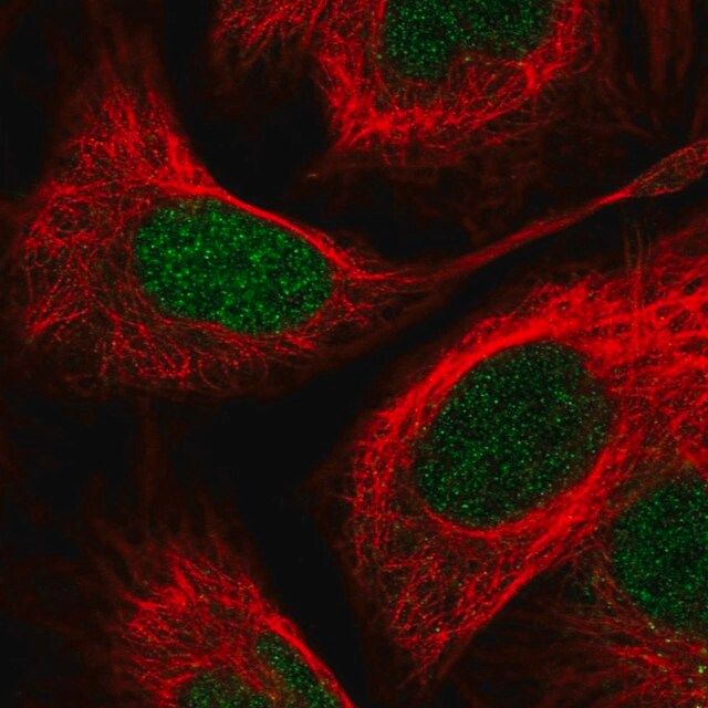 Anti-PITX2 antibody produced in rabbit