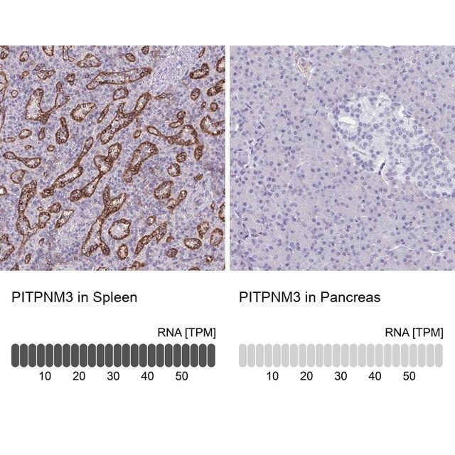 Anti-PITPNM3 antibody produced in rabbit