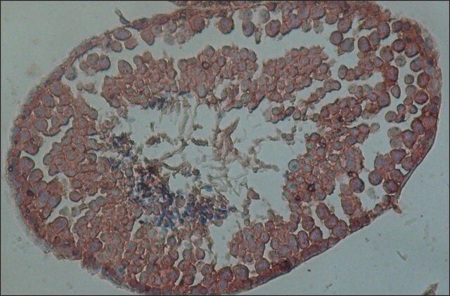 Anti-PIWIL1 antibody, Mouse monoclonal