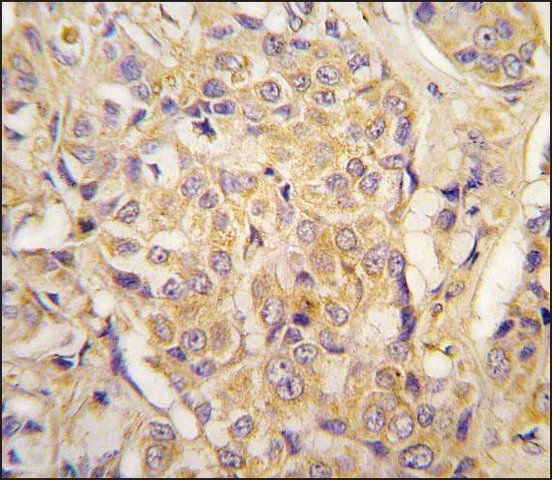 Anti-PIWIL1 (center) antibody produced in rabbit