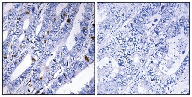 Anti-PKA-R2  antibody produced in rabbit