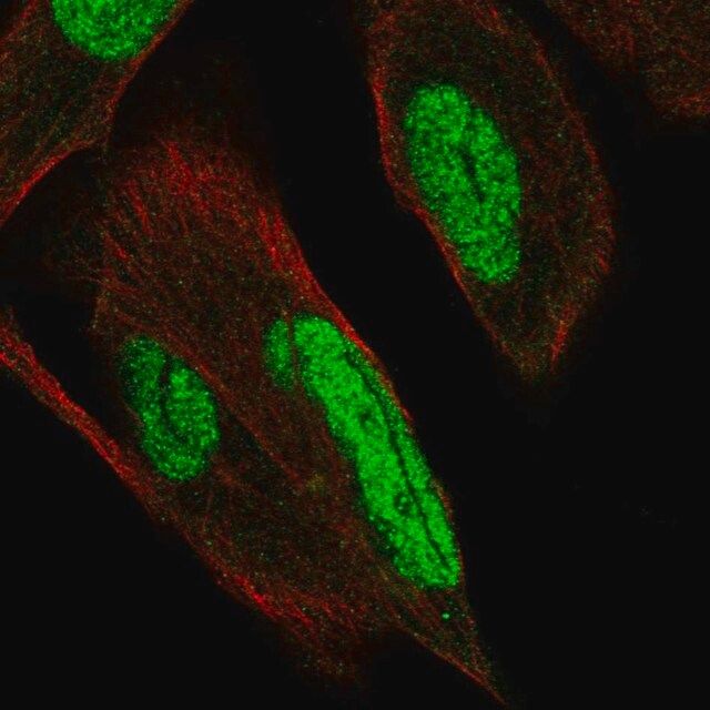 Anti-PKNOX1 antibody produced in rabbit