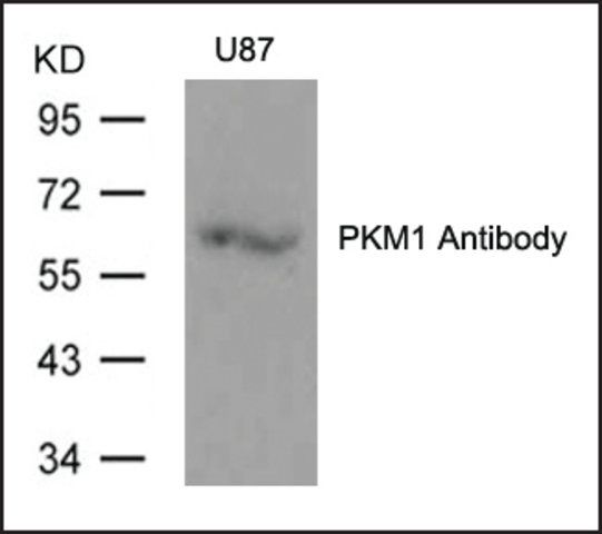 Anti-PKM1 antibody produced in rabbit