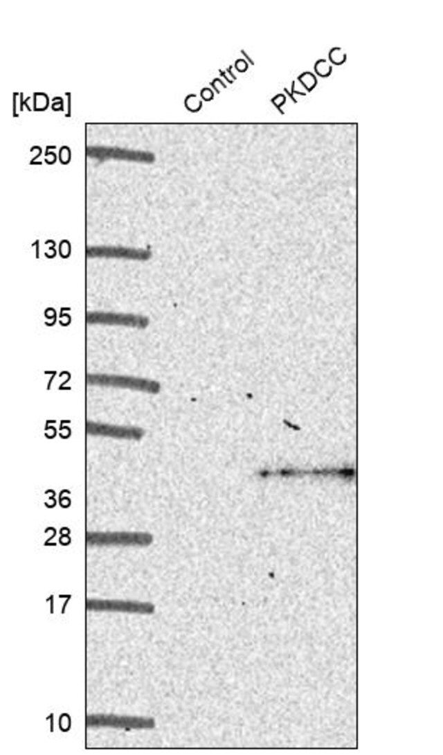 Anti-PKDCC antibody produced in rabbit