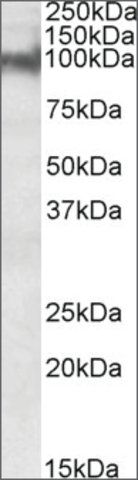 Anti-PKP2 antibody produced in goat