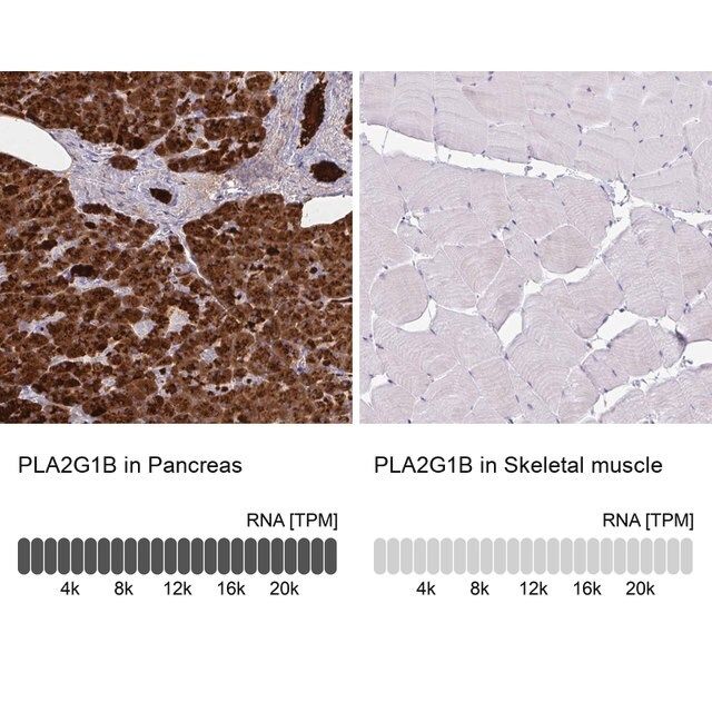 Anti-PLA2G1B antibody produced in rabbit