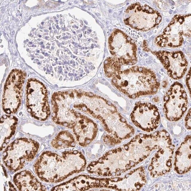 Anti-PKHD1 antibody produced in rabbit