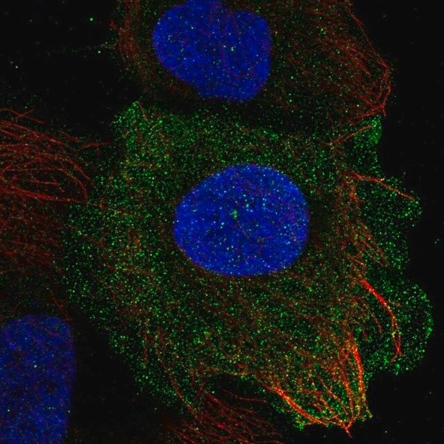 Anti-PLAC8 antibody produced in rabbit