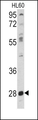 Anti-PKMYT1 (center) antibody produced in rabbit