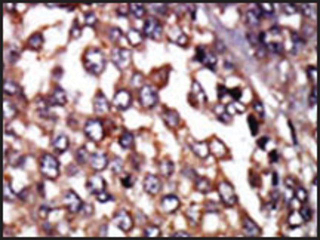 Anti-PKR1 (N-term) antibody produced in rabbit