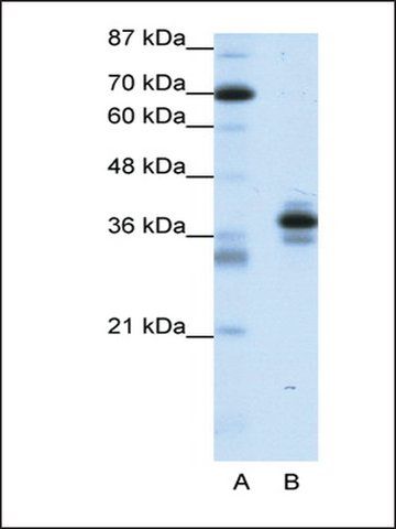 Anti-PITX1 antibody produced in rabbit