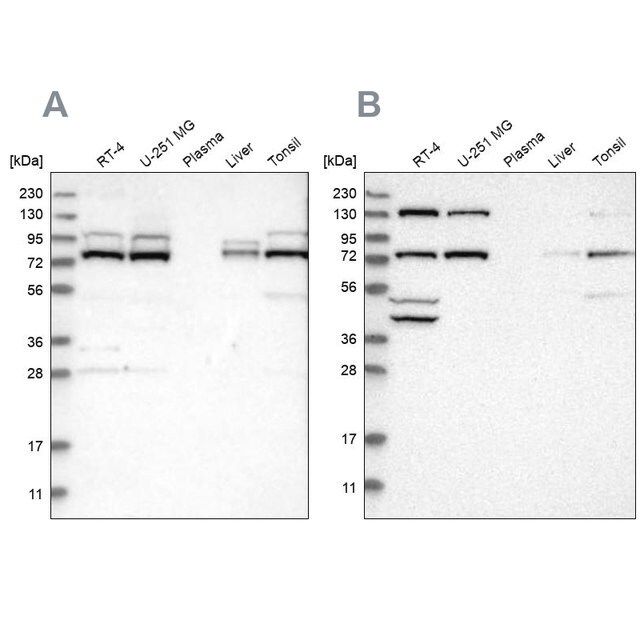 Anti-PLAA antibody produced in rabbit