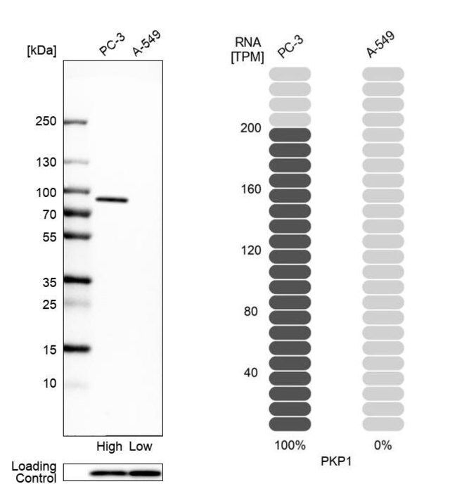 Anti-PKP1 antibody produced in rabbit