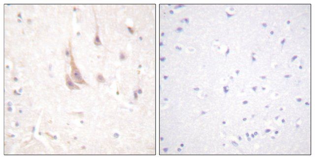 Anti-PKC  antibody produced in rabbit