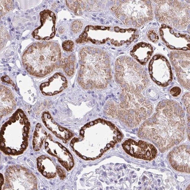 Anti-PLA2G12B antibody produced in rabbit