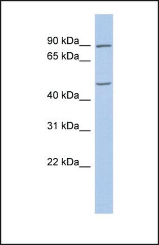 Anti-PLAG1, (C-terminal) antibody produced in rabbit