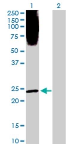 Anti-PLA2G1B antibody produced in rabbit