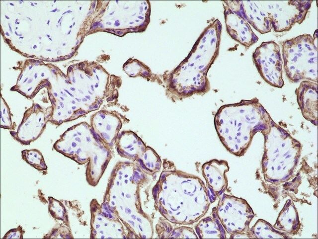 Anti-PLAP antibody, Rabbit monoclonal