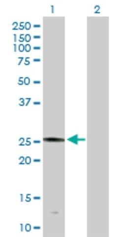 Anti-PLA2G4D antibody produced in rabbit