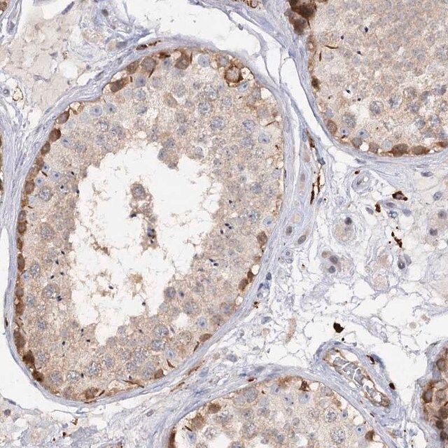 Anti-PIWIL4 antibody produced in rabbit